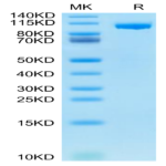 Mouse ENPP-1 Protein BP003627 Syd Labs