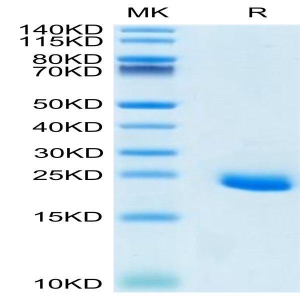 Human Ephrin-A4/EFNA4 Protein (EPA-HM104)