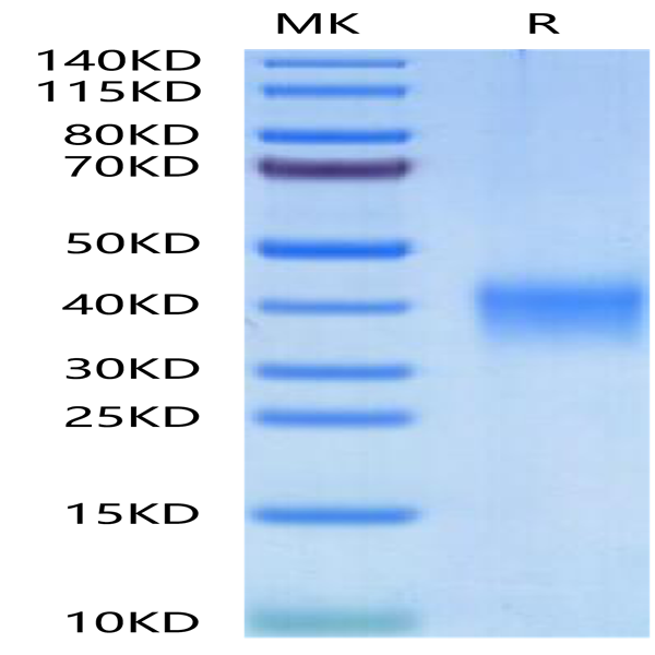 Human EPO/Erythropoietin Protein (EPO-HM001)