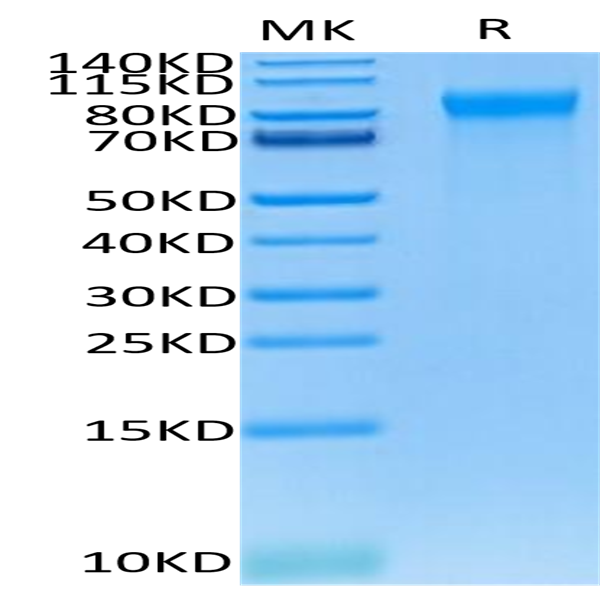 Human E-Selectin/CD62E Protein (ESE-HM401)
