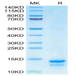 Human FAM19A5 Protein (FAM-HE1A5)