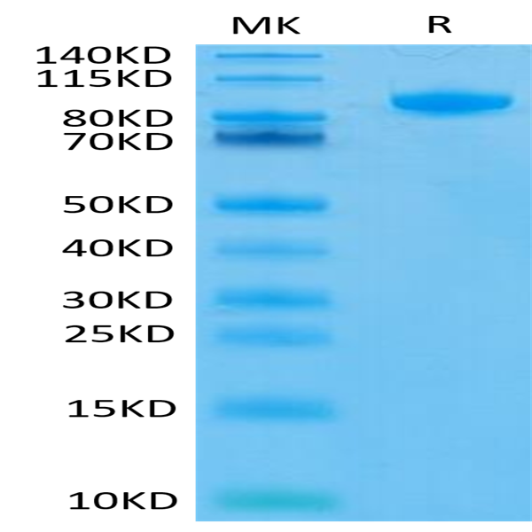 Human FAP Protein (FAP-HM101)