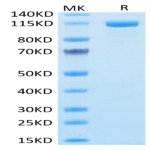 Human FAP Protein (FAP-HM201)