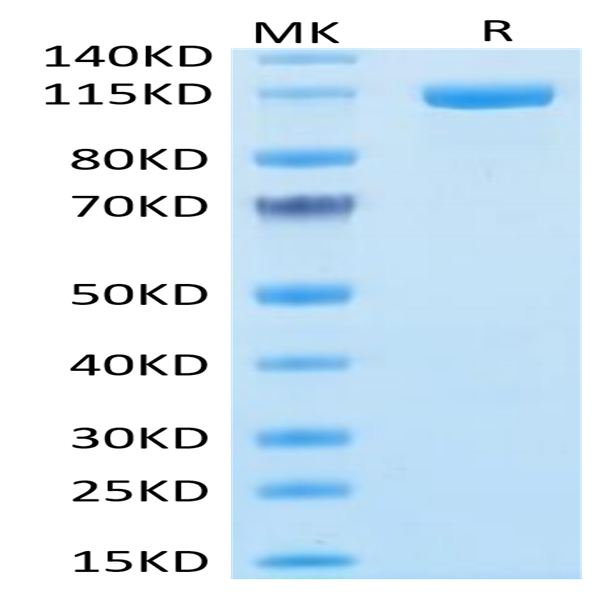 Human FAP Protein (FAP-HM201)
