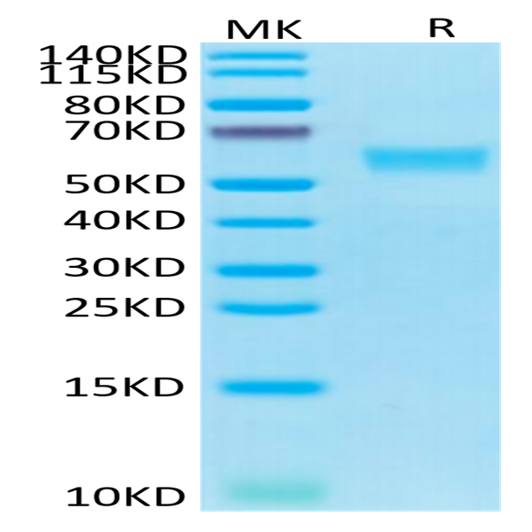 Human Fas/TNFRSF6/CD95 Protein (FAS-HM201)