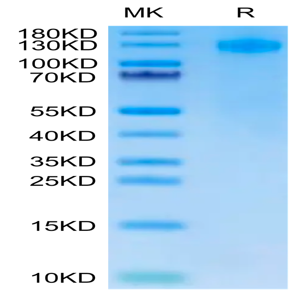 Human FcRH5/FcRL5 Protein (FCR-HM101)