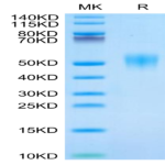 Human Fc gamma RIIIB/CD16b (NA1) Protein (FCR-HM11B)