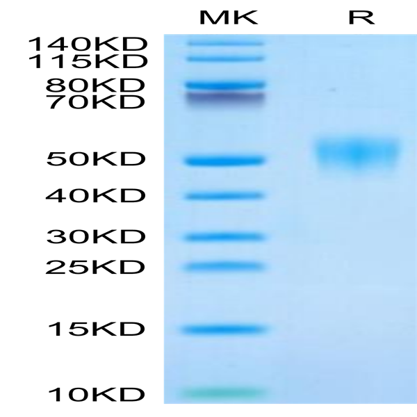Human Fc gamma RIIIB/CD16b (NA1) Protein (FCR-HM11B)