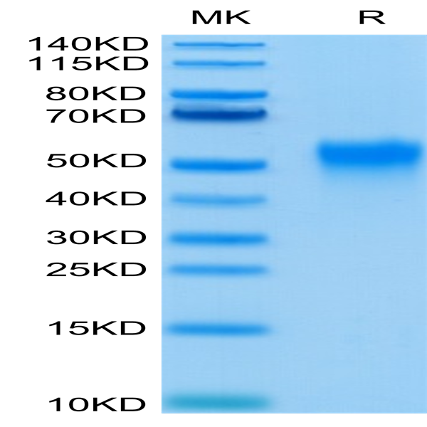 Human Fc gamma RIIIA/CD16a (V176) Protein (FCR-HM43A)