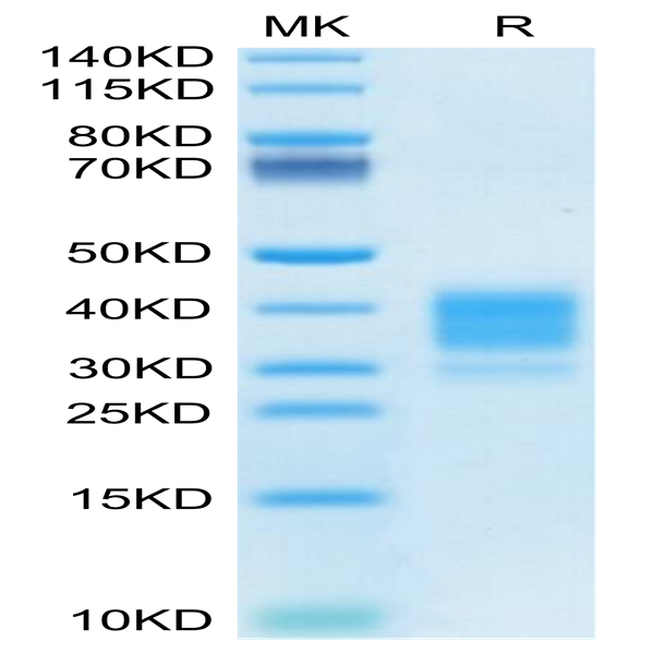 Mouse Fc gamma RIV/CD16-2 Protein (FCR-MM162)