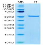 Human FNDC1 Protein (FDC-HE101)