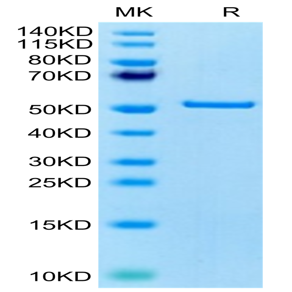 Human FNDC1 Protein (FDC-HE101)
