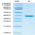 Human FDPS Protein (FDS-HE001)