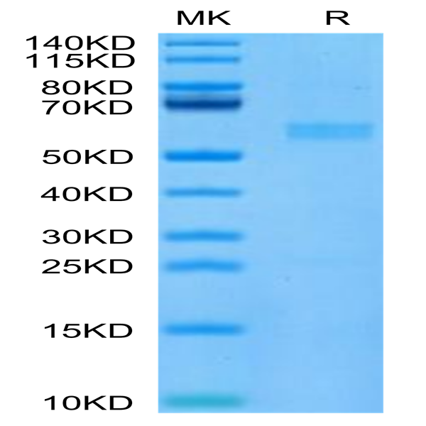Cynomolgus FGF21 Protein (FGF-CM121)