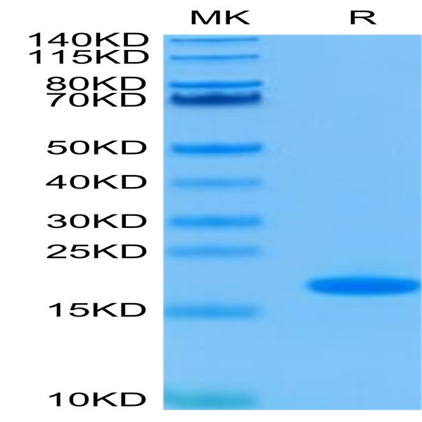 Human FGF basic Protein (FGF-HE001)