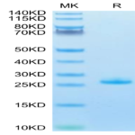 Human FGF21 Protein (FGF-HM121)