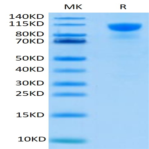 Human FGFR2 alpha (IIIb) Protein (FGF-HM2RA)