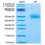Human FGFR1 beta (IIIc) Protein (FGF-HM41C)