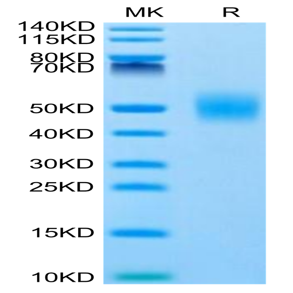 Human FGFR1 beta (IIIc) Protein (FGF-HM41C)
