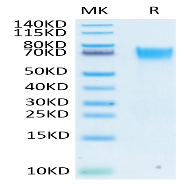 Biotinylated Human FGFR3 alpha (IIIb) Protein (FGF-HM43BB)