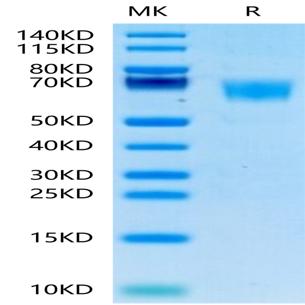 Human FGFR3 alpha (IIIc) Protein (FGF-HM43C)
