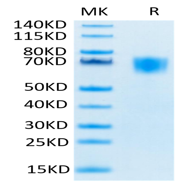 Biotinylated Human FGFR3 alpha (IIIc) Protein (FGF-HM43CB)