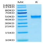 Human FGFR3 beta (IIIb) Protein (FGF-HM4BB)