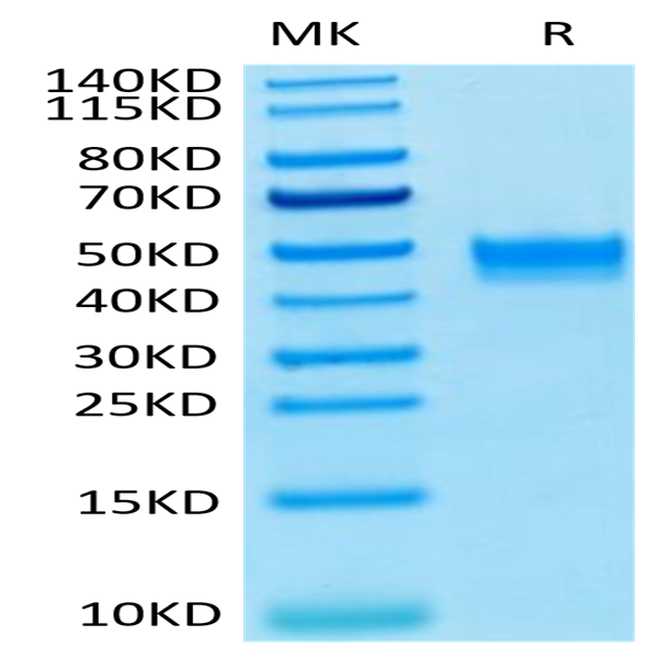 Human FGFR3 beta (IIIb) Protein (FGF-HM4BB)