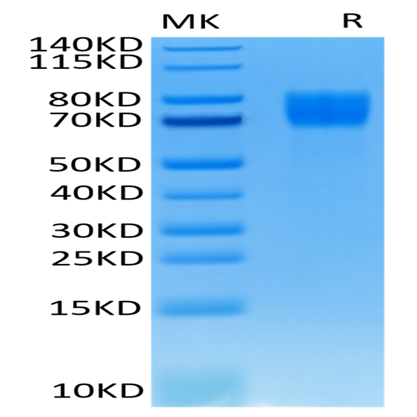 Human FGFR1 alpha (IIIc) Protein (FGF-HM4RA)