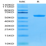Human FGF21 Protein (FGF-HM621)