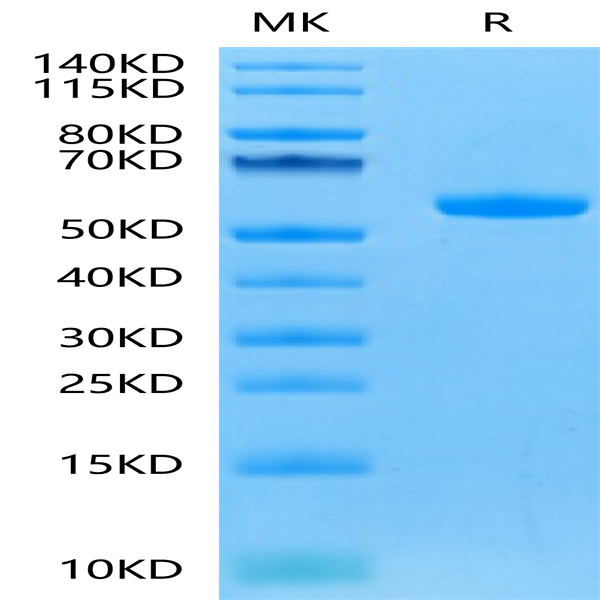 Human FGF21 Protein (FGF-HM621)