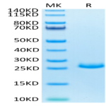 Mouse FGF21 Protein (FGF-MM121)