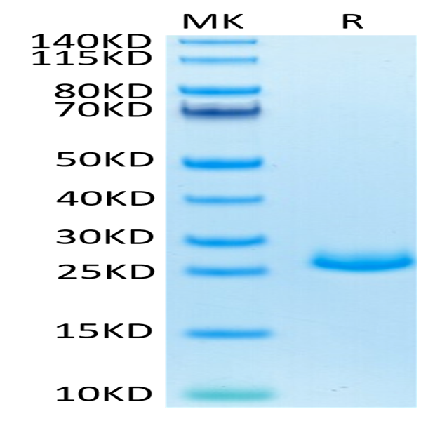 Mouse FGF21 Protein (FGF-MM121)