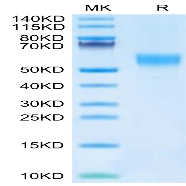 Mouse FGFR3 alpha (IIIb) Protein (FGF-MM43B)