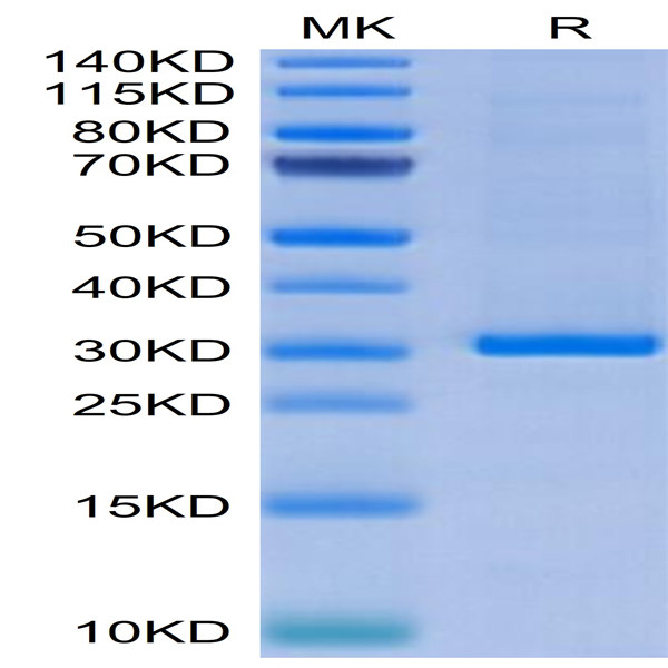 Human FGL1 Protein (FGL-HM411)