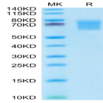 Human FGFR2 alpha (IIIb) Protein (FGR-HM1BD)