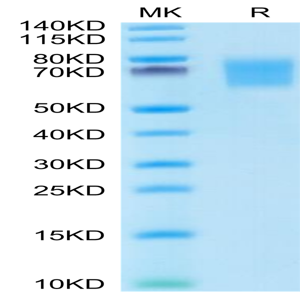 Human FGFR2 alpha (IIIb) Protein (FGR-HM1BD)