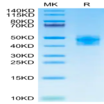 Human Fibronectin (32-345) Protein (FIN-HM101)