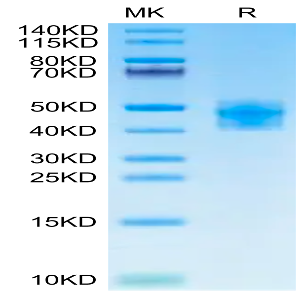 Human Fibronectin (32-345) Protein (FIN-HM101)
