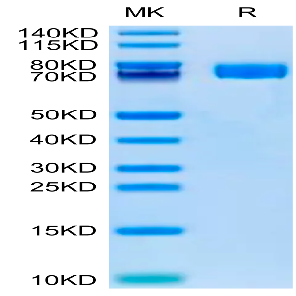 Human Fibronectin (32-602) Protein (FIN-HM102)
