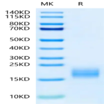 Human Fibronectin (1266-1356) Protein (FIN-HM103)