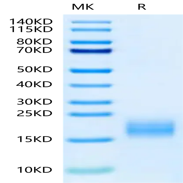 Human Fibronectin (1266-1356) Protein (FIN-HM103)