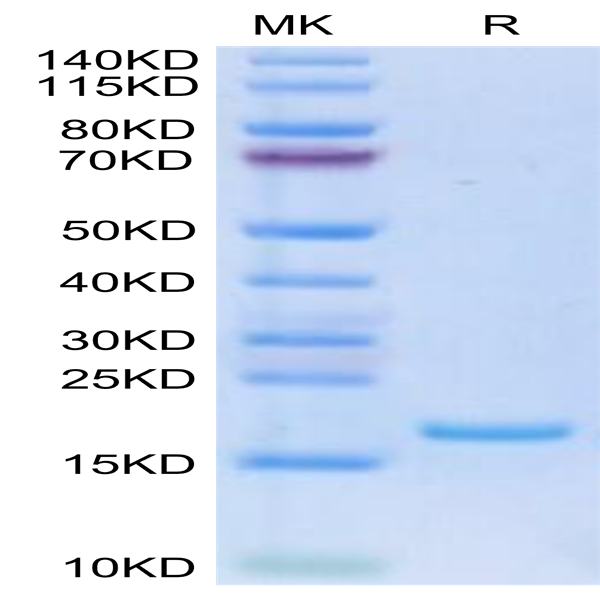 Human FLT3 Ligand Protein (FLT-HE03L)
