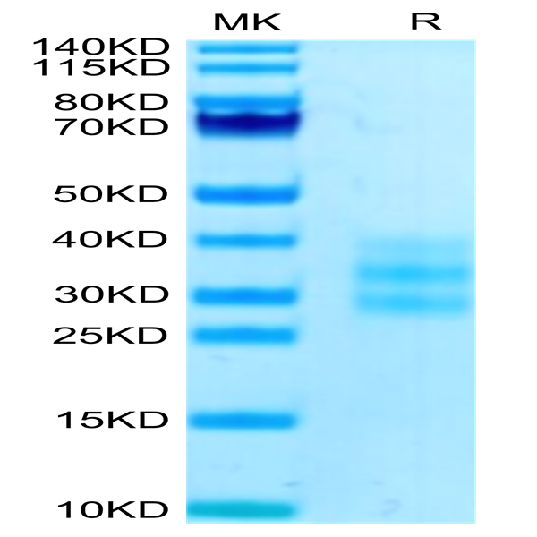 Human FLT3 Ligand Protein (FLT-HM13L)