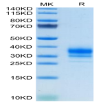 Human FOLR2 Protein (FOL-HM1R2)