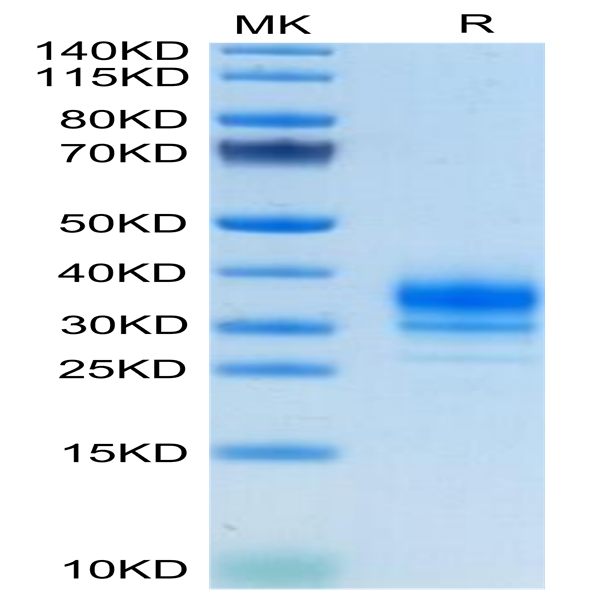 Human FOLR2 Protein (FOL-HM1R2)
