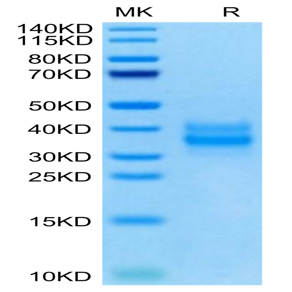 Mouse FOLR1 Protein (FOL-MM1R1)