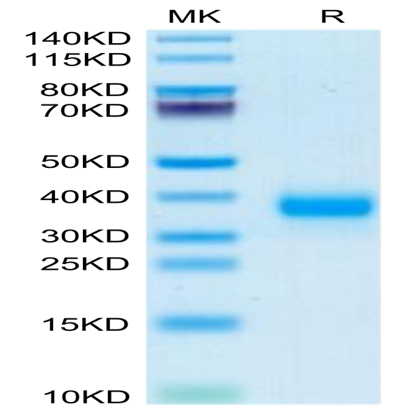 Mouse FOLR4/Juno Protein (FOL-MM1R4)