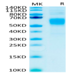 Human Fc gamma RI/CD64 Protein (FRI-HM464)