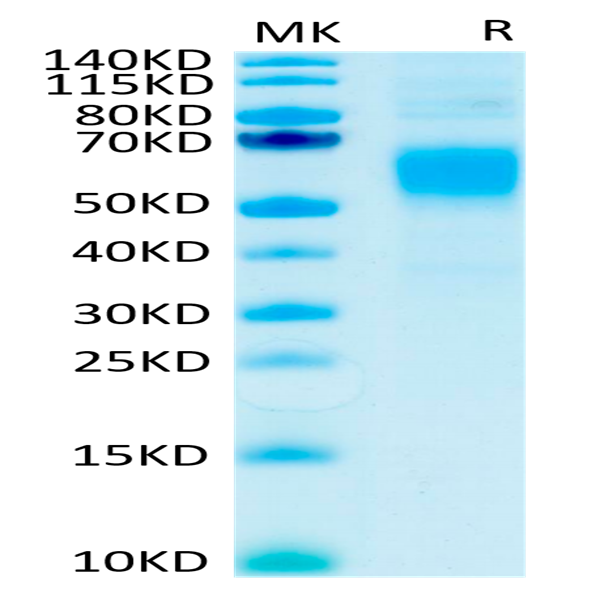 Human Fc gamma RI/CD64 Protein (FRI-HM464)